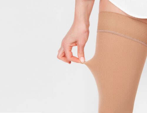 Benefits of Leg Compression Garments for Lymphedema and Lipedema