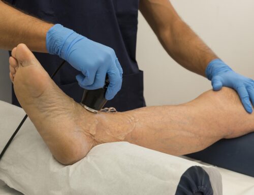 How Shockwave Therapy Offers Relief for Foot Pain