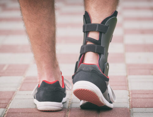 Simple Ways to Stop Skin Irritation When Wearing a Brace