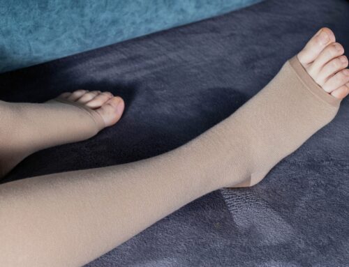 Reduce Swelling Naturally with Compression Socks