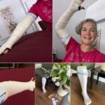 Fast n Go Arm Bandage Review by Caroline Q