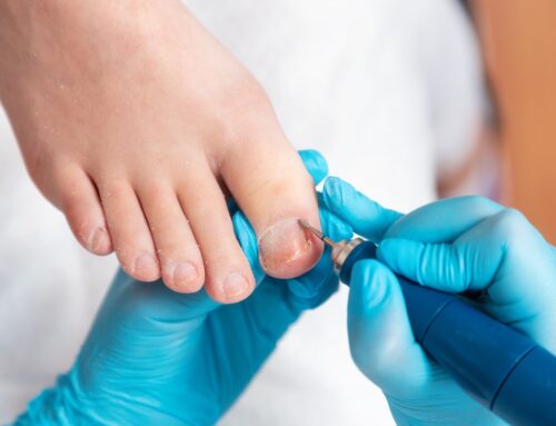 How Chiropodist and Pedorthist Treatments Can Enhance Foot Health