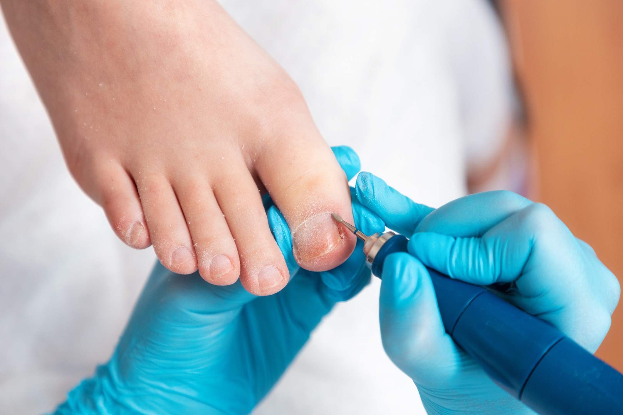 how-chiropodist-and-pedorthist-treatments-can-help-care-med-ltd