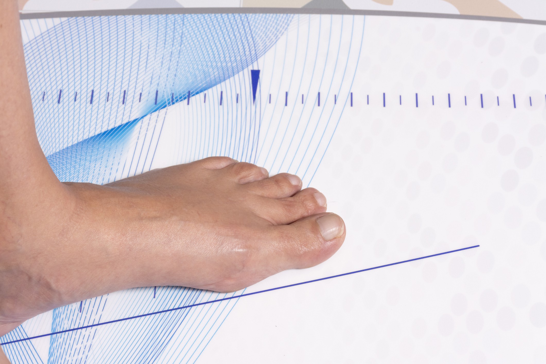 The Link Between Footwear and Preventing Foot Disorders
